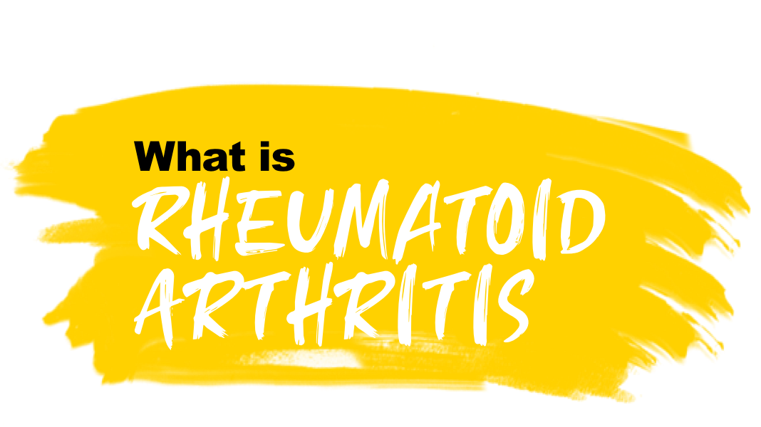 What is rheumatoid arthritis